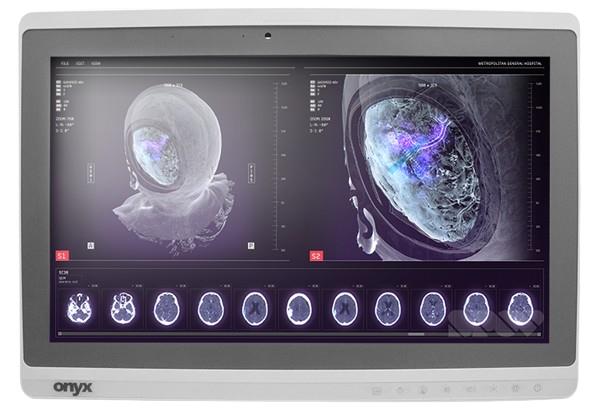Onyx-Zeus-248 Professional Medical AIO i7-6600U/8GB/250GB SSD *TouchScreen* *No Stand*